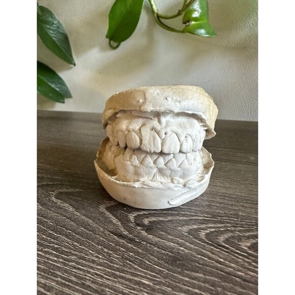 Vintage Dental Teeth Mold Cast – Upper & Lower Set - Picture 1 of 11